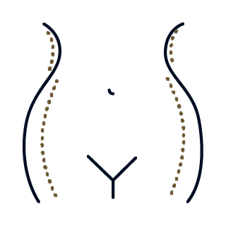 Cadera