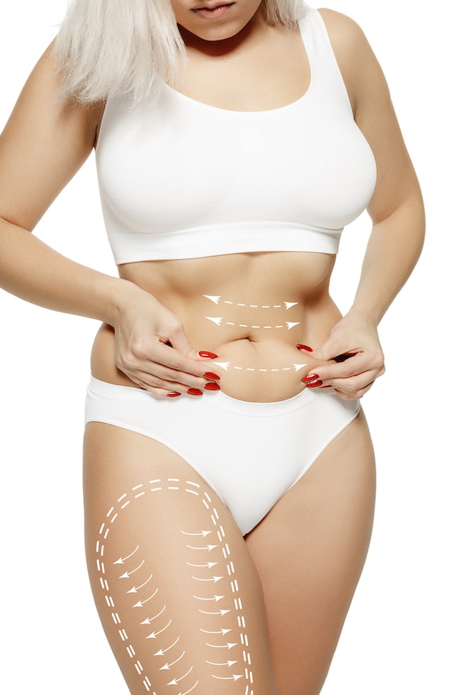 Lipo Vaser Barcelona abdomen